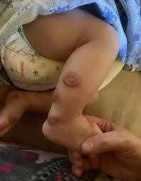 These are the signs that it is cre